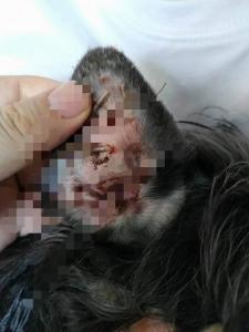 耳血腫病例恢復(fù)